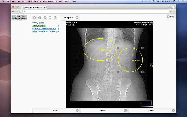 DICOM Medical Image Reader from Chrome web store to be run with OffiDocs Chromium online DICOM Medical Image Reader from Chrome web store to be run with OffiDocs Chromium online